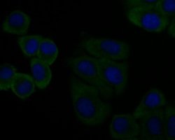 Complement C7 Antibody (15D1), Novus Biologicals 100 uL; Unconjugated:Antibodies,