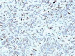 Complement Component C1qA Antibody (C1QA/2952) - Azide and BSA Free, Novus
