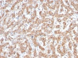 Complement Component C1qA Antibody (C1QA/2952) - Azide and BSA Free, Novus