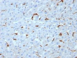 Complement Component C1qA, Mouse anti-Human, Clone: C1QA/2953, Novus Biologicals