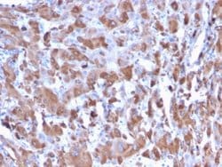 Complement Component C1qA, Mouse anti-Human, Clone: C1QA/2953, Novus Biologicals