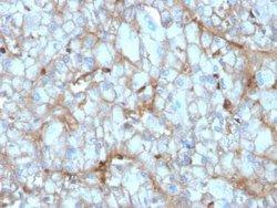 Complement Component C1qA Antibody (C1QA/2954) - Azide and BSA Free, Novus