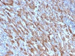 Complement Component C1qA Antibody (C1QA/2954) - Azide and BSA Free, Novus
