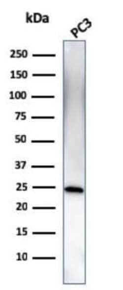 Complement Component C1qA Antibody (C1QA/2954) - Azide and BSA Free, Novus