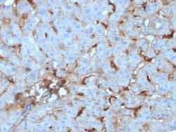 Complement Component C1qA Mouse anti-Human, Clone: C1QA/2955, Novus Biologicals:Antibodies:Primary