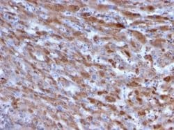 Complement Component C1qA Mouse anti-Human, Clone: C1QA/2955, Novus Biologicals:Antibodies:Primary