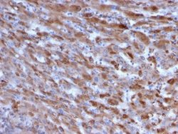 Complement Component C1qA Antibody (C1QA/2955) - Azide and BSA Free, Novus Biologicals 100 &mu;g | Buy Online | Novus Biologicals | Fisher Scientific