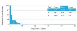 Complement Component C1qA Mouse anti-Human, Clone: C1QA/2955, Novus Biologicals:Antibodies:Primary