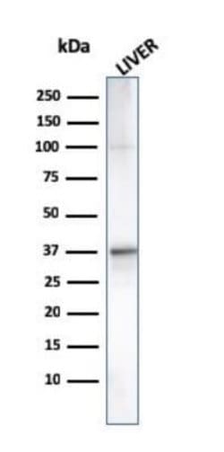 Complement Component C1qA Mouse anti-Human, Clone: C1QA/2955, Novus Biologicals:Antibodies:Primary