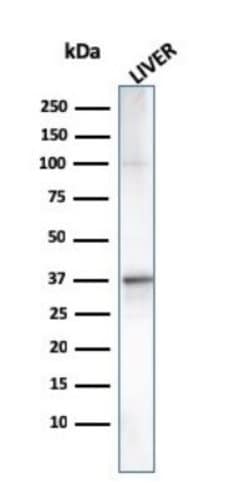 Complement Component C1qA Antibody (C1QA/2955) - Azide and BSA Free, Novus Biologicals 100 &mu;g | Buy Online | Novus Biologicals | Fisher Scientific