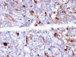 Complement Component C1qA Antibody (C1QA/2956) - Azide and BSA Free, Novus