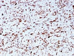 Complement Component C1qA Antibody (C1QA/2956) - Azide and BSA Free, Novus