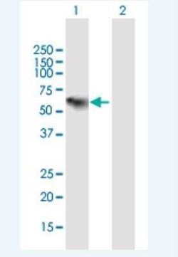 Complement Component C1rLP Antibody, Novus Biologicals 50 &mu;g | Buy Online | Novus Biologicals | Fisher Scientific