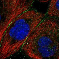Complement Factor B Antibody, Novus Biologicals:Antibodies:Primary Antibodies