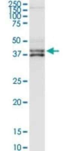 Complement Factor H-related 1/CFHR1/CFHL1 Antibody, Novus Biologicals 0.1 mg | Buy Online | Novus Biologicals | Fisher Scientific