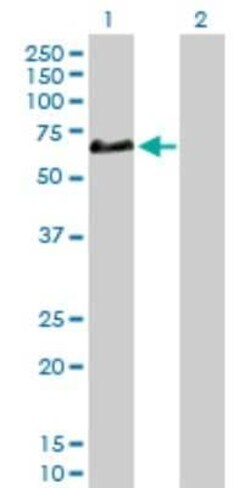 Complement Factor H-related 5/CFHR5 Antibody, Novus Biologicals 0.1 mg;
