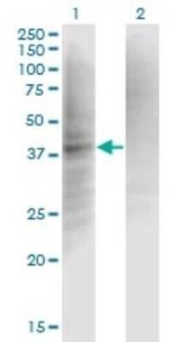 Complement Factor I Antibody (1B3), Novus Biologicals 0.1 mg | Buy Online | Novus Biologicals | Fisher Scientific