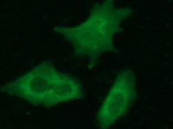 Complexin-2 Rabbit anti-Human, Clone: 21, Novus Biologicals:Antibodies:Primary