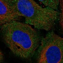 Connexin 25/GJB7 Rabbit anti-Human, Polyclonal, Novus Biologicals:Antibodies:Primary