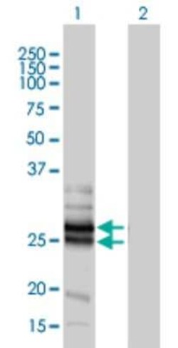Connexin 30.3/GJB4 Antibody (1E3-1C12), Novus Biologicals 0.1 mg | Buy Online | Novus Biologicals | Fisher Scientific
