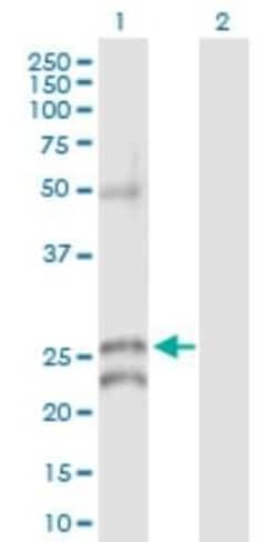 Novus Biologicals Connexin 30.1/GJB5 Antibody, Novus Biologicals 0.1 mg;