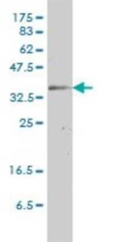 Connexin 31/GJB3 Antibody (3B4-1B3), Novus Biologicals 0.1 mg | Buy Online | Novus Biologicals | Fisher Scientific