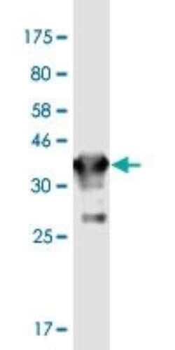 Connexin 36/GJD2 Antibody (5E5), Novus Biologicals 100 &mu;g | Buy Online | Novus Biologicals | Fisher Scientific