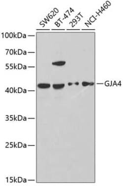 Connexin 37/GJA4 Antibody - BSA Free, Novus Biologicals 0.1 mL, Unconjugated:Anticorps,