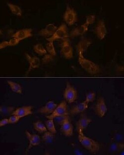 Connexin 50/GJA8 Rabbit anti-Human, Mouse, Rat, Polyclonal, Novus Biologicals:Antibodies:Primary