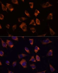 Connexin 50/GJA8 Rabbit anti-Human, Mouse, Rat, Polyclonal, Novus Biologicals:Antibodies:Primary