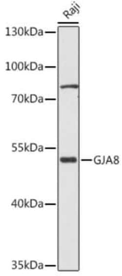 Connexin 50/GJA8 Rabbit anti-Human, Mouse, Rat, Polyclonal, Novus Biologicals:Antibodies:Primary