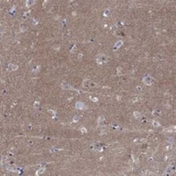 Copine-6 Rabbit anti-Human, Polyclonal, Novus Biologicals 100 &mu;g; Unconjugated:Antibodies,