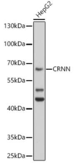 Cornulin Antibody - BSA Free, Novus Biologicals:Antibodies:Primary Antibodies