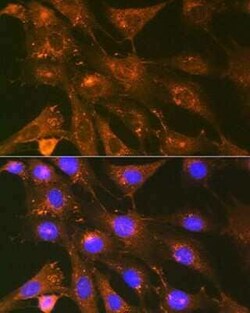 Cortactin Rabbit anti-Human, Mouse, Rat, Clone: 2W5H9, Novus Biologicals