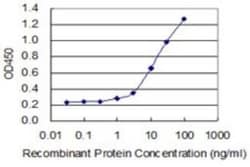 Corticotropin Releasing Factor Antibody (2B11), Novus Biologicals 0.1 mg | Buy Online | Novus Biologicals | Fisher Scientific