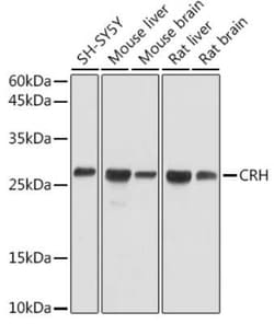 Corticotropin Releasing Factor Rabbit anti-Human, Mouse, Rat, Polyclonal, Novus Biologicals 20 &mu;g | Buy Online | Bio-Techne | Fisher Scientific