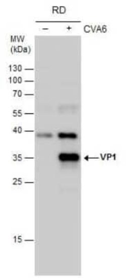 Coxsackievirus A6 VP1 Antibody, Novus Biologicals 100 μg; Unconjugated:Antibodies,