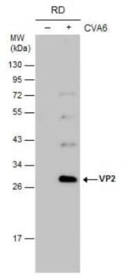 Coxsackievirus A6 VP2 Antibody, Novus Biologicals 100 &mu;g | Buy Online | Bio-Techne | Fisher Scientific
