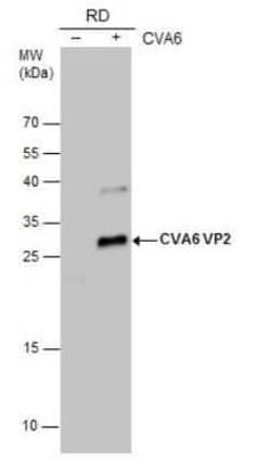 Coxsackievirus A6 VP2 Antibody, Novus Biologicals 100 &mu;g; Unconjugated:Antibodies,