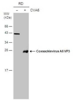 Coxsackievirus A6 VP3 Antibody, Novus Biologicals 100 &mu;g | Buy Online | Novus Biologicals | Fisher Scientific