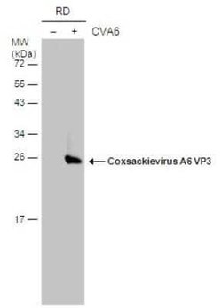 Coxsackievirus A6 VP3 Antibody, Novus Biologicals 100 &mu;g | Buy Online | Novus Biologicals | Fisher Scientific