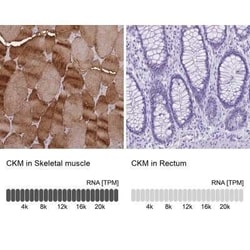 Creatine Kinase, Muscle/CKMM Antibody, Novus Biologicals 25 &mu;L; Unconjugated:Antikörper
