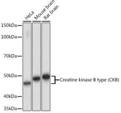 Creatine Kinase BB Rabbit anti-Human, Mouse, Rat, Clone: 1G10U9, Novus Biologicals 100 &mu;g | Buy Online | Novus Biologicals | Fisher Scientific