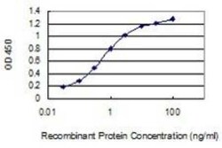 Creatine Kinase, Muscle/CKMM Antibody (1E3), Novus Biologicals 0.1 mg | Buy Online | Novus Biologicals | Fisher Scientific