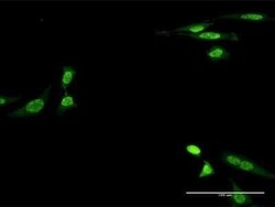 Creatine Kinase, Muscle/CKMM Antibody (2F3-B11), Novus Biologicals 0.1