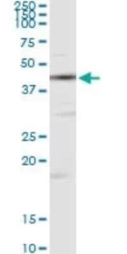 Creatine Kinase, Muscle/CKMM Antibody (2F3-B11), Novus Biologicals 0.1