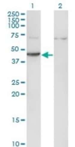 Creatine Kinase, Muscle/CKMM Antibody (2F3-B11), Novus Biologicals 0.1