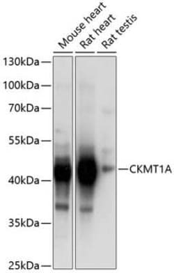 Creatine kinase MT 1A Antibody - BSA Free, Novus Biologicals 100 &mu;g;