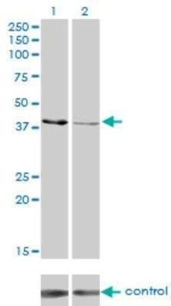 Creatine kinase MT 1B Antibody (2C8), Novus Biologicals 0.1 mg | Buy Online | Novus Biologicals | Fisher Scientific
