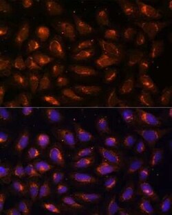 Creatine kinase MT 1B Antibody - Azide and BSA Free, Novus Biologicals